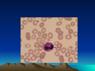 Clase hemograma-