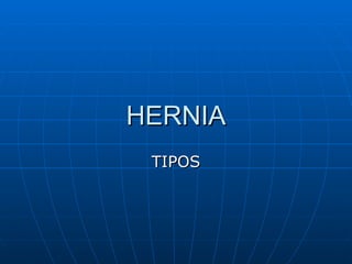 HERNIA TIPOS 