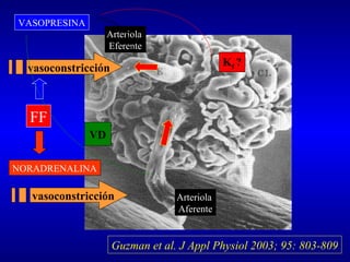 Arteriola
Eferente
Arteriola
Aferente
NORADRENALINA
vasoconstricción
VASOPRESINA
vasoconstricción
FF
Kf ?
VD
Guzman et al. J Appl Physiol 2003; 95: 803-809
 