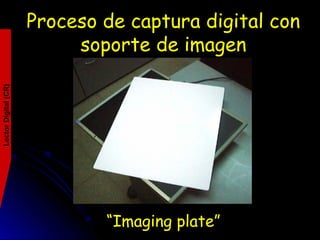 Proceso de captura digital con
soporte de imagen
“Imaging plate”
LectorDigital(CR)
 
