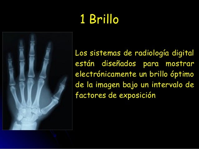 Resultado de imagen para brillo de la imagen radiografica digital