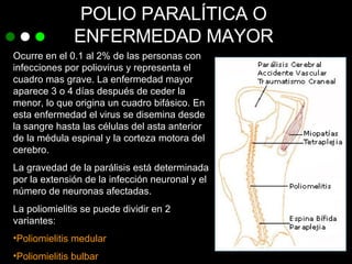 POLIO PARALÍTICA O ENFERMEDAD MAYOR Ocurre en el 0.1 al 2% de las personas con infecciones por poliovirus y representa el cuadro mas grave. La enfermedad mayor aparece 3 o 4 días después de ceder la menor, lo que origina un cuadro bifásico. En esta enfermedad el virus se disemina desde la sangre hasta las células del asta anterior de la médula espinal y la corteza motora del cerebro. La gravedad de la parálisis está determinada por la extensión de la infección neuronal y el número de neuronas afectadas. La poliomielitis se puede dividir en 2 variantes: Poliomielitis medular Poliomielitis bulbar 