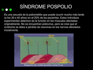 SÍNDROME POSPOLIO Es una secuela de la poliomielitis que puede ocurrir mucho más tarde  (a los 30 o 40 años) en el 20% de los pacientes. Estos individuos experimentan deterioro de la función en los músculos afectados originalmente. No se encuentran poliovirus, pero se cree que el síndrome se deba a pérdida de neuronas en los nervios afectados inicialmente. 