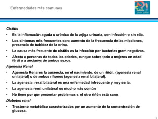 Cistitis
• Es la inflamación aguda o crónica de la vejiga urinaria, con infección o sin ella.
• Los síntomas más frecuentes son: aumento de la frecuencia de las micciones,
presencia de turbidez de la orina.
• La causa más frecuente de cistitis es la infección por bacterias gram negativas.
• Afecta a personas de todas las edades, aunque sobre todo a mujeres en edad
fértil o a ancianos de ambos sexos.
Agenesia Renal
• Agenesia Renal es la ausencia, en el nacimiento, de un riñón, (agenesia renal
unilateral) o de ambos riñones (agenesia renal bilateral).
• La agenesia renal bilateral es una enfermedad infrecuente y muy seria.
• La agenesia renal unilateral es mucho más común
• No tiene por qué presentar problemas si el otro riñón está sano.
Diabetes renal
• Trastorno metabólico caracterizados por un aumento de la concentración de
glucosa.
Enfermedades más comunes
16
 