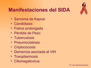Sarcoma de Kaposi Candidiasis Fiebre prolongada Pérdida de Peso Tuberculosis Pneumocistiosis Criptococosis Demencia asociada al VIH Toxoplasmosis Citomegalovirus Manifestaciones del SIDA Dr. Jair García-Guerrero 