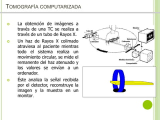 TOMOGRAFÍA COMPUTARIZADA 
 La obtención de imágenes a 
través de una TC se realiza a 
través de un tubo de Rayos X. 
 Un haz de Rayos X colimado 
atraviesa al paciente mientras 
todo el sistema realiza un 
movimiento circular, se mide el 
remanente del haz atenuado y 
los valores se envían a un 
ordenador. 
 Éste analiza la señal recibida 
por el detector, reconstruye la 
imagen y la muestra en un 
monitor. 
 