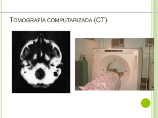 TOMOGRAFÍA COMPUTARIZADA (CT) 
Dr. Jose A Carde-Serrano 
 