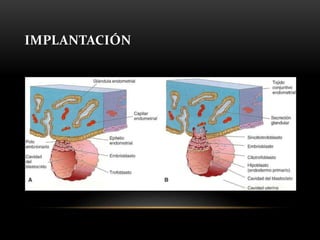 IMPLANTACIÓN
 