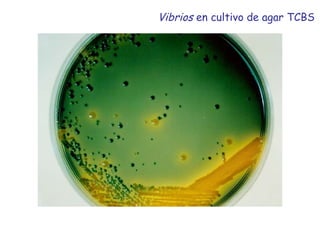 Vibrios en cultivo de agar TCBS
 