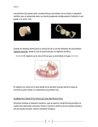Clase 1
3
Las prótesis fija suelen estar recubiertas por porcelanas con un núcleo o esqueleto
metálico que va cementada sobre un diente preparado biológicamente (tallado) el cual
puede o no estar vital.
Cuando no tenemos diente para la colocación de la corona hablamos de una prótesis
implanto-asistida
>>>>>>>>>>>>El implante es la raíz artificial que va atornillado al hueso <<<<<<<<<<<
, donde la raíz es sustituida por un implante metálico
El implante se coloca en la zona donde se ha perdido la pieza dentaria luego se
atornilla un pilar donde ira cementada una prótesis fija.
Entonces tenemos el elemento mecánico, que es nuestra rehabilitación protésica la
cuales esta destinada a devolver forma y función y estética de los tejidos bucales y
son los tejidos bucales nuestro elemento biológico.
ELEMENTOS CONSTITUTIVOS DE UNA PROTESIS FICA
 
