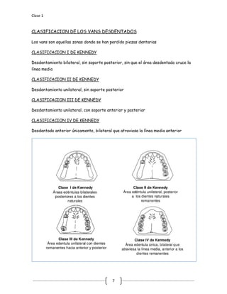 Clase 1
7
Los vans son aquellas zonas donde se han perdido piezas dentarias
CLASIFICACION DE LOS VANS DESDENTADOS
Desdentamiento bilateral, sin soporte posterior, sin que el área desdentada cruce la
línea media
CLASIFICACION I DE KENNEDY
Desdentamiento unilateral, sin soporte posterior
CLASIFICACION II DE KENNEDY
Desdentamiento unilateral, con soporte anterior y posterior
CLASIFICACION III DE KENNEDY
Desdentado anterior únicamente, bilateral que atraviesa la línea media anterior
CLASIFICACION IV DE KENNEDY
 