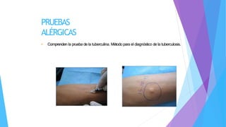 PRUEBAS
ALÉRGICAS
• Comprenden la prueba de la tuberculina. Método para el diagnóstico de la tuberculosis.
 