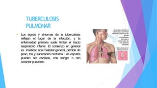TUBERCULOSIS
PULMONAR
• Los signos y síntomas de la tuberculosis
reflejan el lugar de la infección, y la
enfermedad primaria suele limitar el tracto
respiratorio inferior. El comienzo en general
es insidioso con malestar general, pérdida de
peso, tos y sudoración nocturna. Los esputos
pueden ser escasos, con sangre o con
carácter purulento.
 