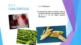 2.1.1
CARACTERÍSTICAS
• 2.1.1.1Morfológicas
Son bacilos finos, largos e inmóviles a veces se
encuentran aislados y otras agrupados en forma
de N, V, L. En los cultivos aparecen
filamentosos.
 