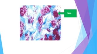 Globis
Prof.OdelaisSuarezMoreno.Baciloscopíadelalepra.InstitutodeMedicinaTropical“PedroKourí”Ciudad
Habana,Cuba2007.ANEXO4
 