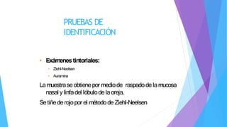 PRUEBAS DE
IDENTIFICACIÓN
• Exámenestintoriales:
• Ziehl-Neelsen
• Auramina
Lamuestraseobtienepor mediode raspadodelamucosa
nasal ylinfadel lóbulodelaoreja.
Setiñederojopor el métodode Ziehl-Neelsen
 