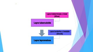• Clasificación:
Sepresenta en dos tipos principalesy dos intermedias.
 