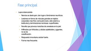 • Lepratuberculoide:
• Nervios se destruyen; dan lugar a fenómenos neuríticos.
• Lesiones en forma de máculas grandes en tejidos
corporales mas fríos comopiel (nariz, oído externoy
testículos) yterminacionesnerviosas superficiales.
• Neuritis que provoca manchas de anestesia en la piel.
• Infiltradas por linfocitos y células epitelioides y gigantes,
no se da
caseificación.
• Respuestainmunitariacelular fuerte.
• Formamas frecuente.
Fase principal
 