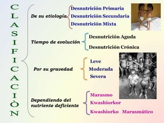 De su etiología
Desnutrición Primaria
Desnutrición Secundaria
Desnutrición Mixta
Tiempo de evolución
Desnutrición Aguda
Desnutrición Crónica
Por su gravedad
Leve
Moderada
Severa
Dependiendo del
nutriente deficiente
Marasmo
Kwashiorkor
Kwashiorko Marasmático
 