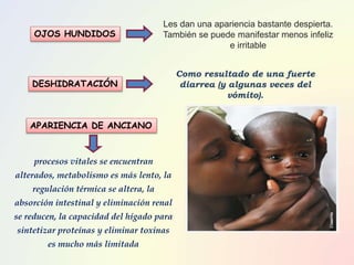 Les dan una apariencia bastante despierta.
También se puede manifestar menos infeliz
e irritable
Como resultado de una fuerte
diarrea (y algunas veces del
vómito).
procesos vitales se encuentran
alterados, metabolismo es más lento, la
regulación térmica se altera, la
absorción intestinal y eliminación renal
se reducen, la capacidad del hígado para
sintetizar proteínas y eliminar toxinas
es mucho más limitada
OJOS HUNDIDOS
DESHIDRATACIÓN
APARIENCIA DE ANCIANO
 