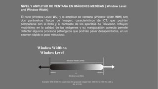 Window Level Ad Window Width CLASE 10 PROCESAMIENTO DE IMAGEN DIGITAL a.pptx