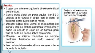 Anudar:
➢ Coger con la mano izquierda el extremo distal
de la sutura.
➢ Con la parte distal del porta-agujas, dar 2 ó 3
vueltas a la sutura y coger con el porta el
extremo distal sujeto con la mano.
➢ Deslizar sobre este último el entrelazado del
porta y tirar de ambos extremos firmemente y
hacia un lado de la unión de los bordes, para
que el nudo no quede sobre esta unión.
➢ Realizar la misma maniobra en sentido
contrario, haciendo un nudo inverso al
anterior.
➢ Los nudos deben estar alineados en el mismo
lado de la incisión.
 