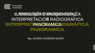 Mg. ALONSO CALDERON QUISPE
RADIOLOGÍA E IMAGENOLOGÍA I
INTERPRETACIÓN RADIOGRÁFICA
PANORAMICA
 