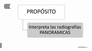 PROPÓSITO
Interpreta las radiografías
PANORAMICAS
 