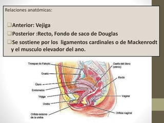 Relaciones anatómicas:
Anterior: Vejiga
Posterior :Recto, Fondo de saco de Douglas
Se sostiene por los ligamentos cardinales o de Mackenrodt
y el musculo elevador del ano.
 