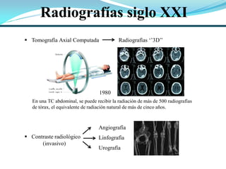 Radiografías siglo XXI
 Tomografía Axial Computada Radiografías „‟3D‟‟
 Contraste radiológico
(invasivo)
Angiografía
Linfografía
Urografía
1980
En una TC abdominal, se puede recibir la radiación de más de 500 radiografías
de tórax, el equivalente de radiación natural de más de cinco años.
 