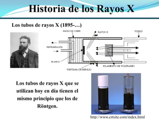 Los tubos de rayos X (1895-…)
Los tubos de rayos X que se
utilizan hoy en día tienen el
mismo principio que los de
Röntgen.
Historia de los Rayos X
http://www.crtsite.com/index.html
 