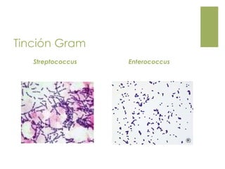 Tinción Gram
Streptococcus Enterococcus
 