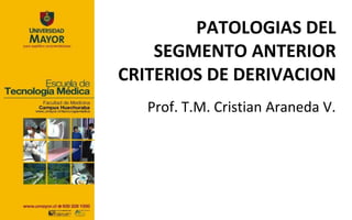 PATOLOGIAS DEL
    SEGMENTO ANTERIOR
CRITERIOS DE DERIVACION
   Prof. T.M. Cristian Araneda V.
 