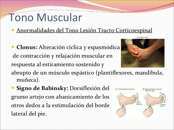 Clase 12 Tono Muscular Normal y sus alteraciones Clase 12 Tono Muscular Normal y sus alteraciones