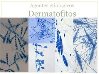 Agentes etiologicos
Dermatofitos
 