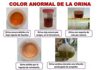 CLASE_13_ANATOMIA_Y_FISIOLOGIA_DEL_SISTEMA_RENAL.pdf