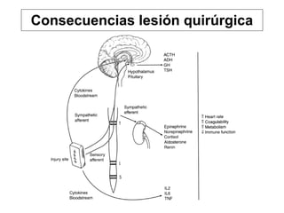 Consecuencias lesión quirúrgica
 
