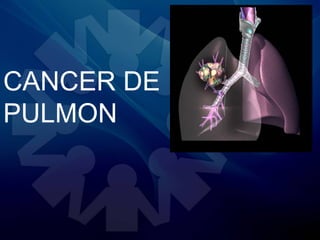CANCER DE 
PULMON 
 