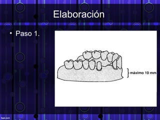 Elaboración
• Paso 1.
 
