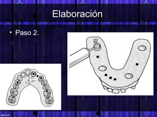 Elaboración
• Paso 2.
 