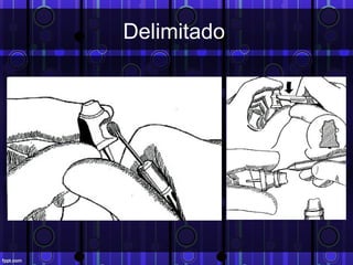 Delimitado
 