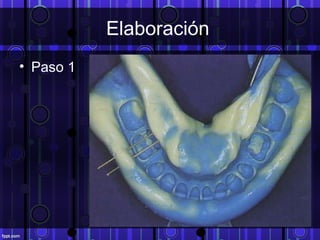 Elaboración
• Paso 1
 