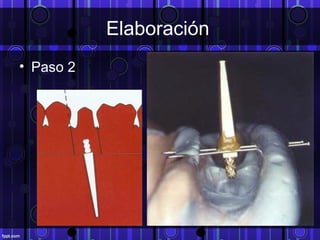 Elaboración
• Paso 2
 