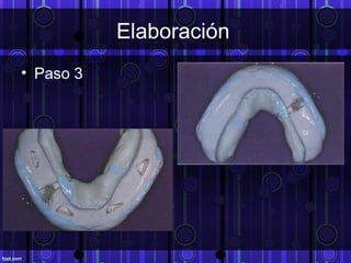 Elaboración
• Paso 3
 