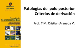Patologías del polo posterior
      Criterios de derivación

     Prof. T.M. Cristian Araneda V.
 