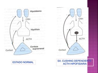 ESTADO NORMAL
SX. CUSHING DEPENDIENTE
ACTH HIPOFISIARIA
 