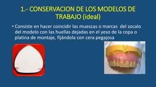 1.- CONSERVACION DE LOS MODELOS DE
TRABAJO (ideal)
• Consiste en hacer coincidir las muescas o marcas del zocalo
del modelo con las huellas dejadas en el yeso de la copa o
platina de montaje, fijándola con cera pegajosa
 