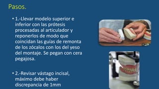 Pasos.
• 1.-Llevar modelo superior e
inferior con las prótesis
procesadas al articulador y
reponerlos de modo que
coincidan las guías de remonta
de los zócalos con los del yeso
del montaje. Se pegan con cera
pegajosa.
• 2.-Revisar vástago incisal,
máximo debe haber
discrepancia de 1mm
 