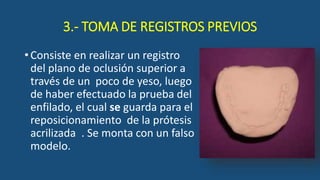 3.- TOMA DE REGISTROS PREVIOS
•Consiste en realizar un registro
del plano de oclusión superior a
través de un poco de yeso, luego
de haber efectuado la prueba del
enfilado, el cual se guarda para el
reposicionamiento de la prótesis
acrilizada . Se monta con un falso
modelo.
 