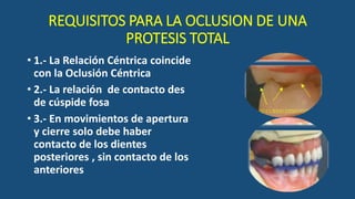 REQUISITOS PARA LA OCLUSION DE UNA
PROTESIS TOTAL
• 1.- La Relación Céntrica coincide
con la Oclusión Céntrica
• 2.- La relación de contacto des
de cúspide fosa
• 3.- En movimientos de apertura
y cierre solo debe haber
contacto de los dientes
posteriores , sin contacto de los
anteriores
 